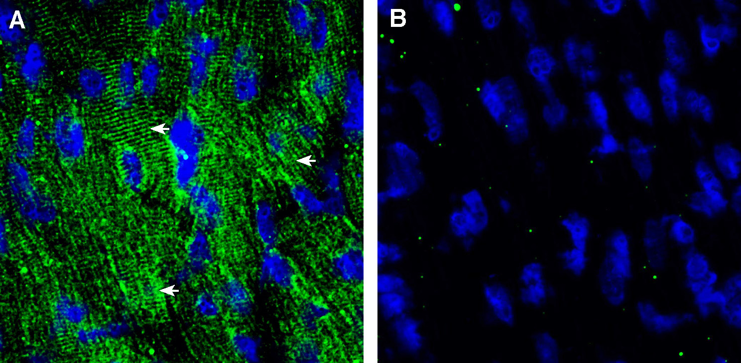 Expression of Ca V β2 in mouse heart.