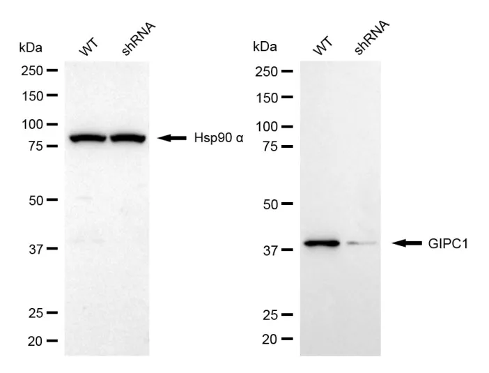 KVAb00643