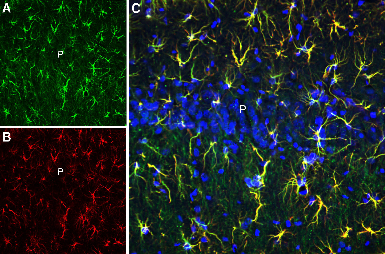 Multiplex staining of CLEC7A and GFAP in rat hippocampal CA1 region