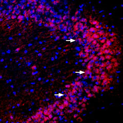 Expression of PICK1 in mouse hippocampus