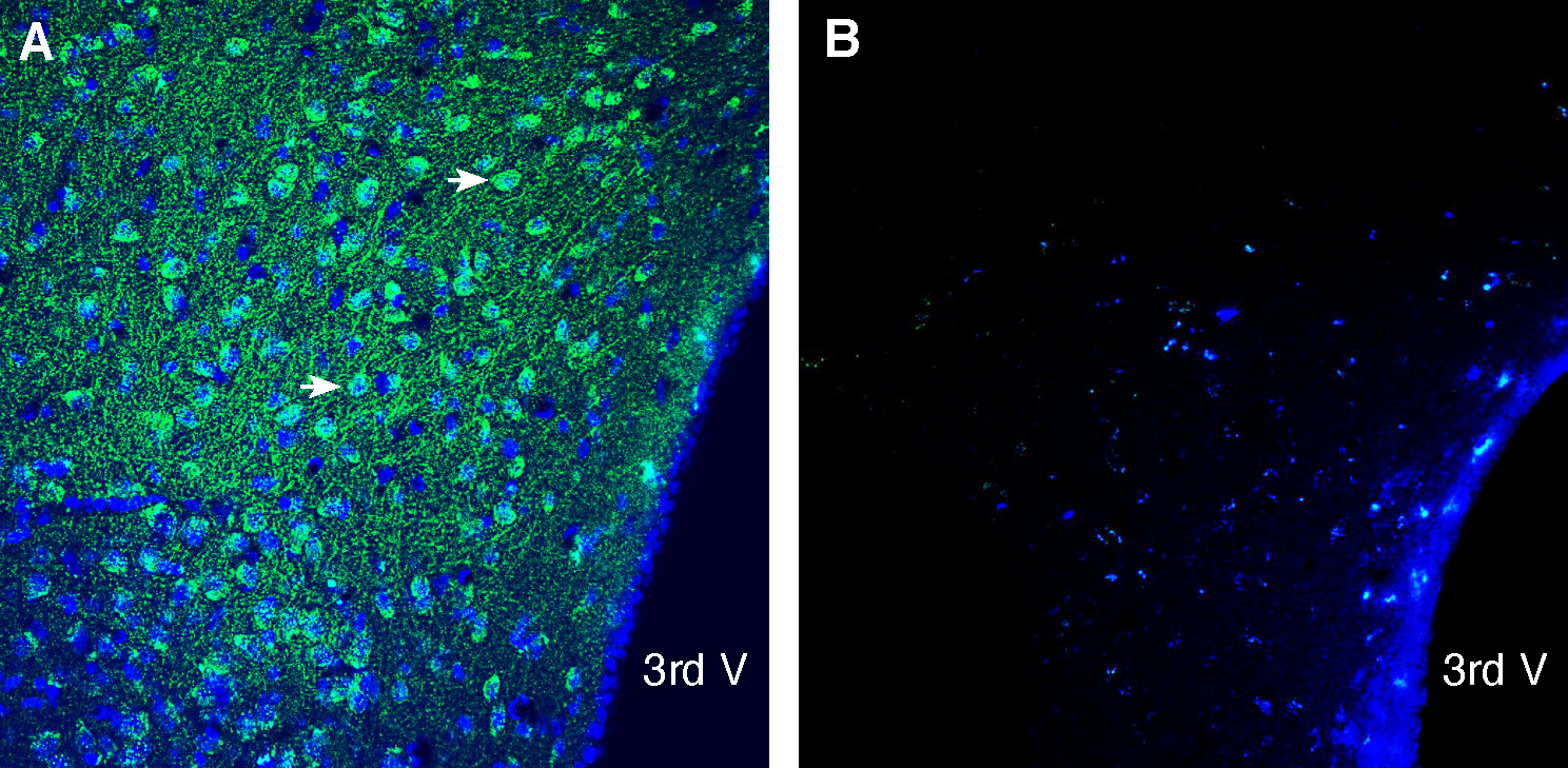 Expression of CD63 in aged mouse (18 months) hypothalamus.