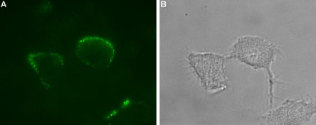 Expression of P2X1 receptor in rat PC12 cells