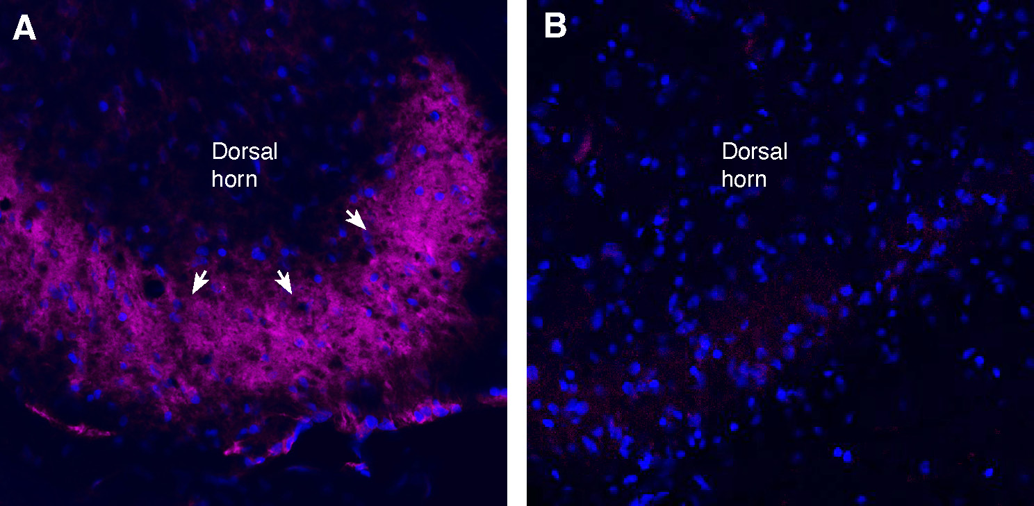 Expression of TRPV1 in rat spinal cord dorsal horn region: