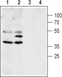Western blot analysis of mouse (lanes 1 and 3) and rat (lanes 2 and 4) brain lysates: