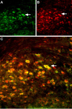Multiplex staining of GluN2A and GluN2B in mouse deep cerebellar nucleus