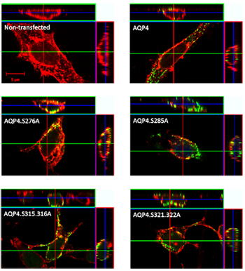 AQP4 Serine phosphorylation is not required for plasma membrane trafficking.