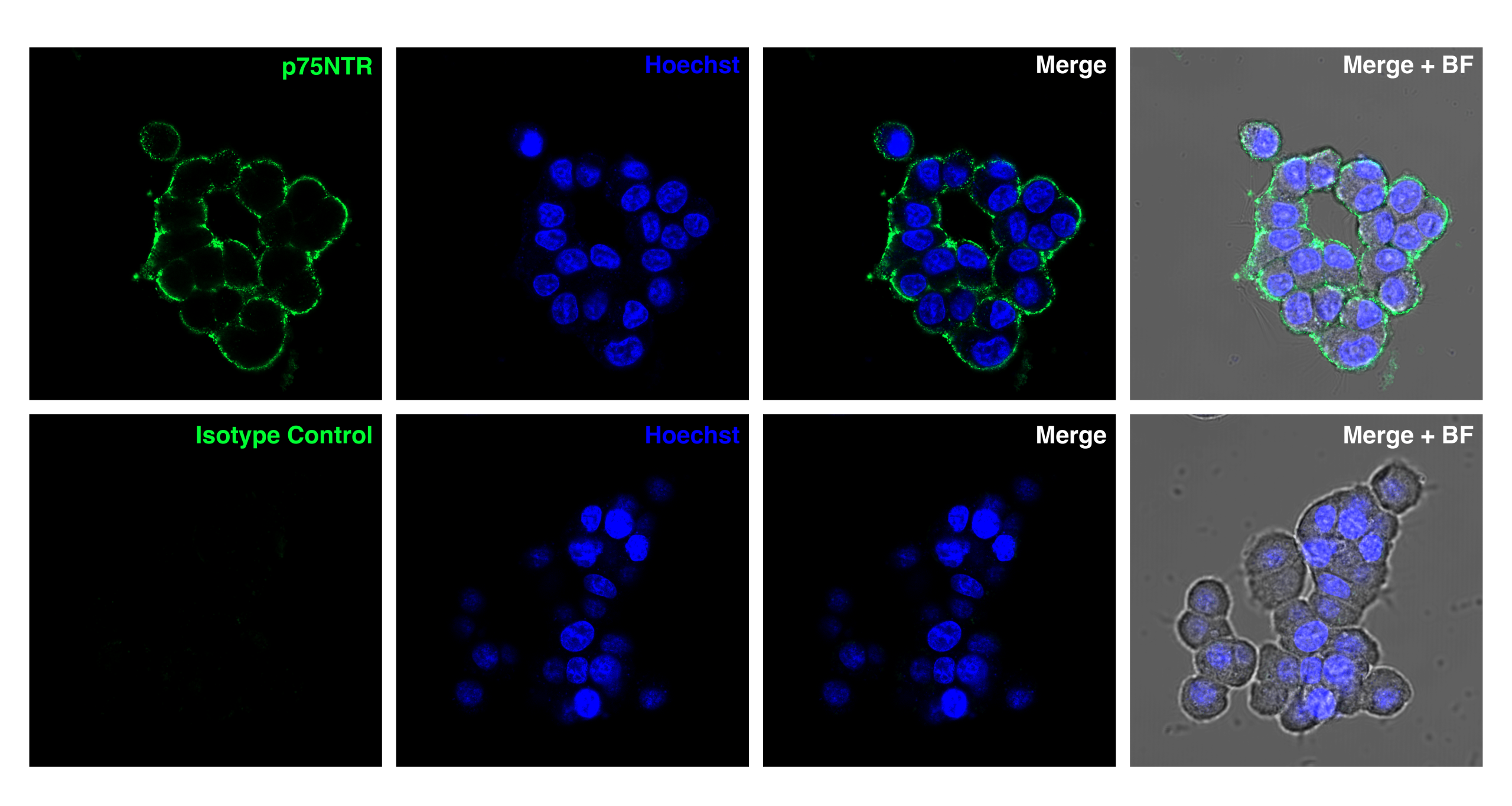 Detection of p75 NTR in rat PC12 cells