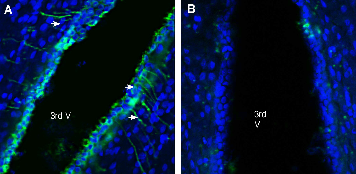 Expression of GABA(A) Receptor Beta 2 in rat hypothalamus.