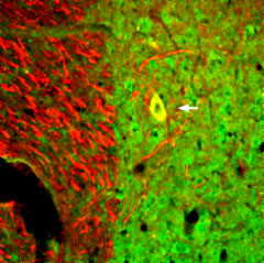 Expression of Neurotrophin 3 in mouse spinal cord