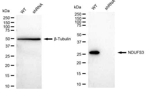 KVAb01753