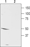 Western blot analysis of mouse brain membranes: