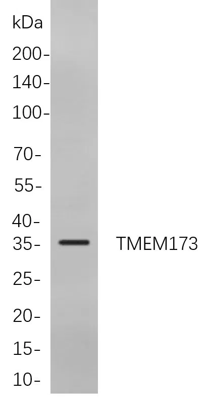 AMRe21585