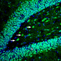 Expression of EphB4 in rat hippocampus