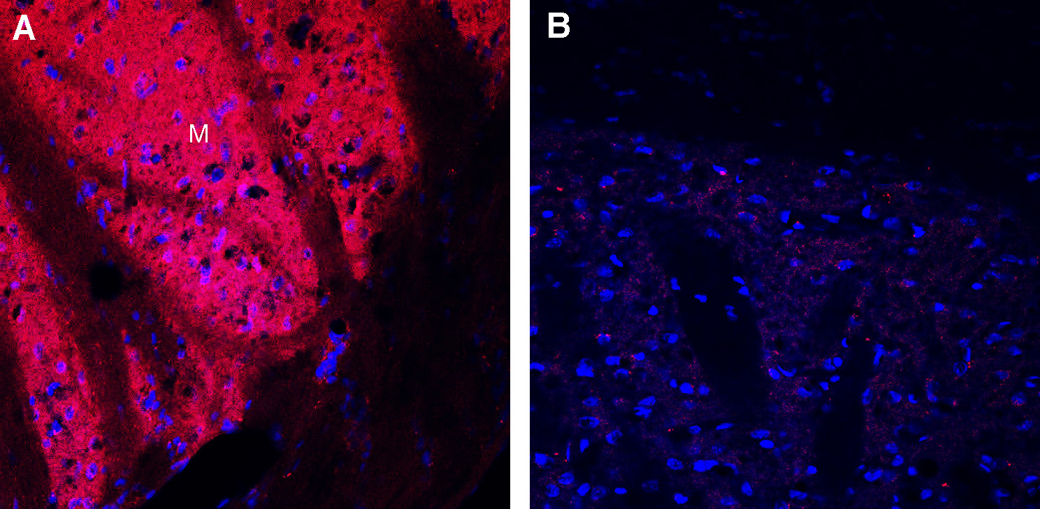 Expression of Dopamine Transporter (DAT) in rat striatum.