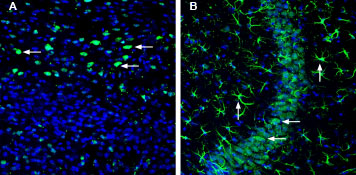 Expression of OCT3 (SLC22A3) in mouse cortex and hippocampus