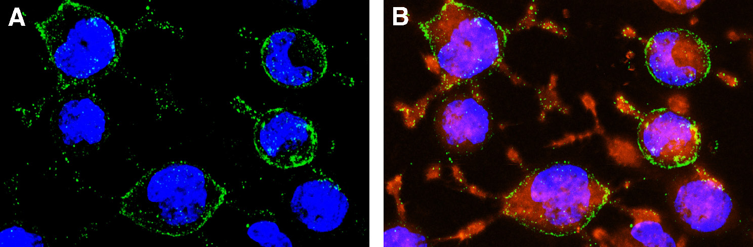 Expression of Na V 1.7 in live intact human U-87 MG glioma cell line