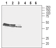 Western blot analysis of rat brain membranes (lanes 1 and 4), mouse brain membranes (lanes 2 and 5) and human SH-SY5Y neuroblastoma cell lysate (lanes 3 and 6):
