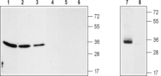 Western blot analysis of rat kidney (lanes 1 and 4), rat brain (lanes 2 and 5), mouse brain (lanes 3 and 6) membranes and human CCF-SSTGI brain astrocytoma (lanes 7 and 8) cell line lysate: