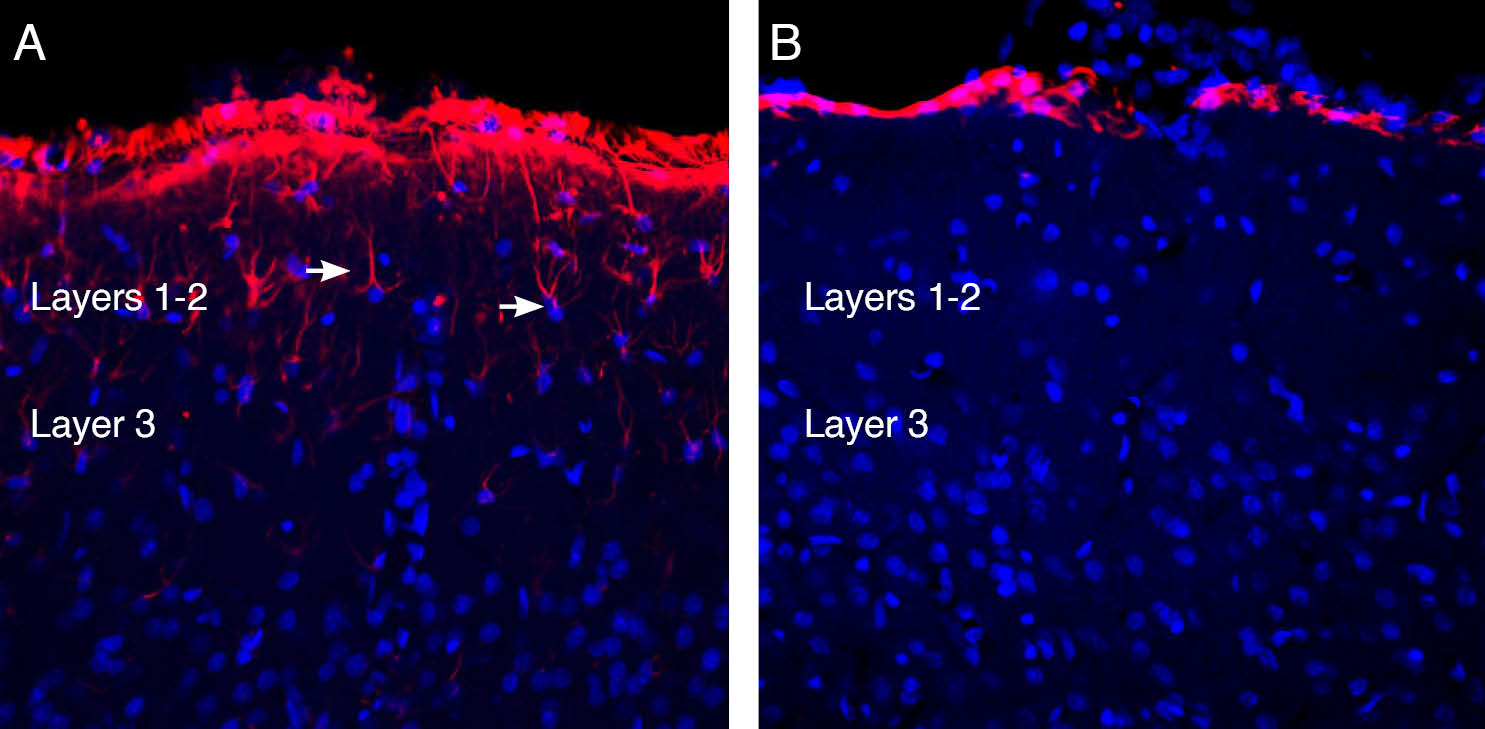 Expression of GFAP in rat parietal cortex.