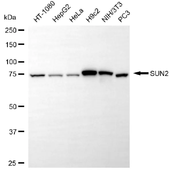 KVAb01305