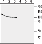 Western blot analysis of human THP-1 monocytic leukemia cell line lysate (lanes 1 and 4), human Jurkat T-cell leukemia cell line lysate (lanes 2 and 5) and human MCF-7 breast adenocarcinoma cell line lysate (lanes 3 and 6):