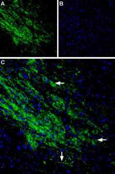 Expression of GIRK2 (K ir 3.2) in mouse brain