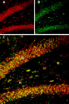 Multiplex staining of BDNF and proBDNF in rat hippocampus