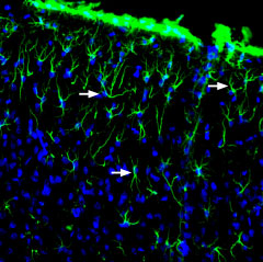 Expression of GFAP in rat brain
