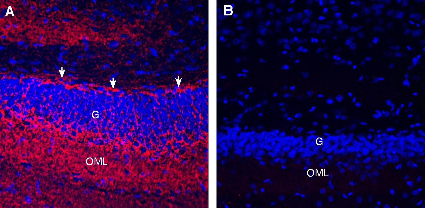 Expression of GAP43 in rat hippocampus.