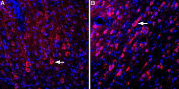 Expression of Glutamate receptor δ1 in rat cortex and medial septum