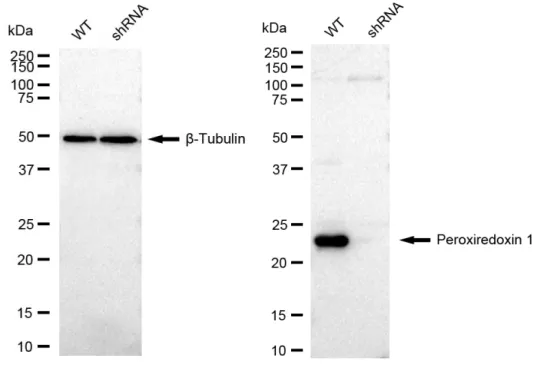 KVAb01759