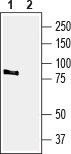 Western blot analysis of rat brain membranes:
