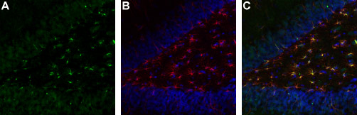 Expression of TrkA in rat brain hippocampal dentate gyrus