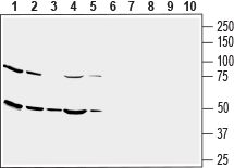Western blot analysis of human U-87 MG glioblastoma cell line lysate (lanes 1 and 6), human THP-1 monocytic leukemia cell line lysate (lanes 2 and 7), human SH-SY5Y neuroblastoma cell line lysate (lanes 3 and 8), human MEG-01 megakaryoblastic leukemia