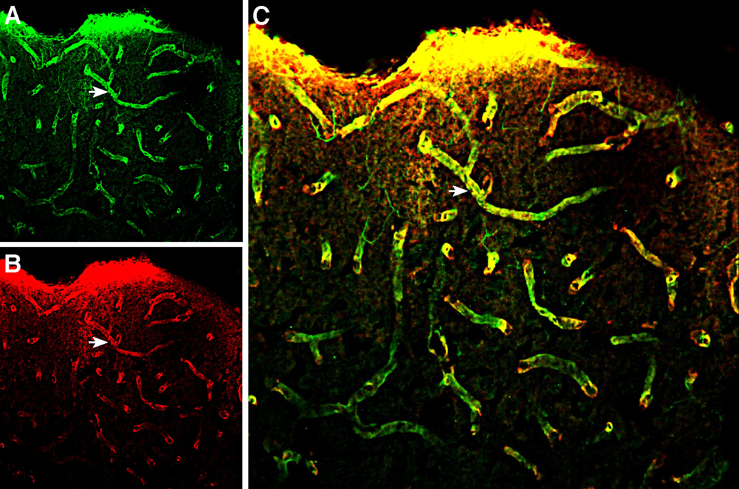 Multiplex staining of MERTK and Aquaporin 4 in rat parietal cortex.