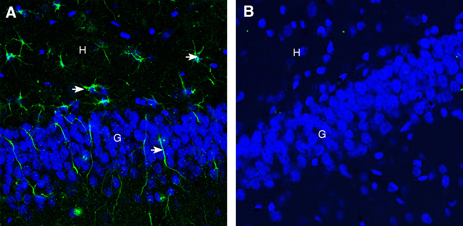 Expression of CD9 in rat hippocampus.