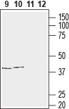 Western blot analysis of human T-cell leukemia (Jurkat) (lanes 9 and 11) and human neuroblastoma (SH-SY5Y) (lanes 10 and 12) cell line lysates: