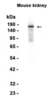 AMRe87011