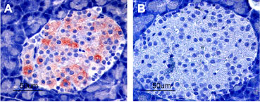 Expression of K ir 6.2 in rat pancreas