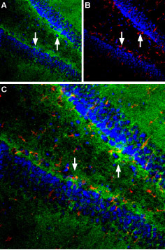 Expression of EAAT1 in rat hippocampus