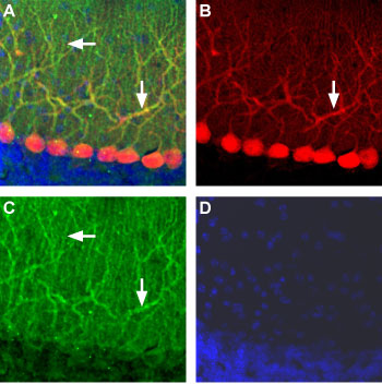 Expression of AMPA Receptor 2 (GluA2) in rat cerebellum