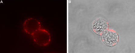 Expression of SSTR2 in human HT-29 cells