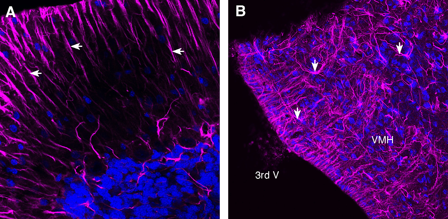 Expression of GFAP in rat cerebellum and hypothalamus.