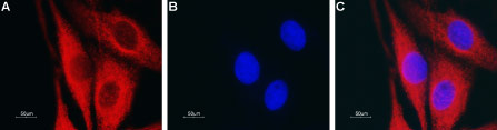 Expression of Aquaporin 4 in rat glioma C6 cells
