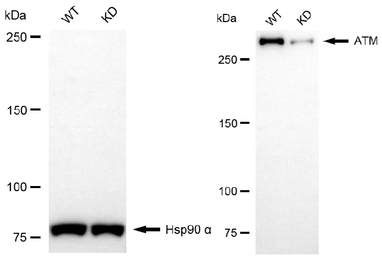 KVAb01439