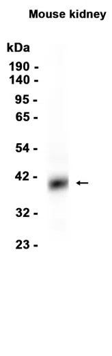 AMRe86868