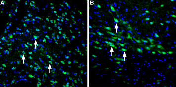 Expression of LRRK2 in rat striatum and substantia nigra