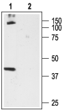 Western blot analysis of rat brain membrane proteins: