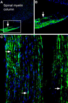 Expression of Periaxin in rat peripheral nerve