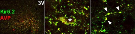 Expression of K ir 6.2 in rat suprachiasmatic nucleus sections